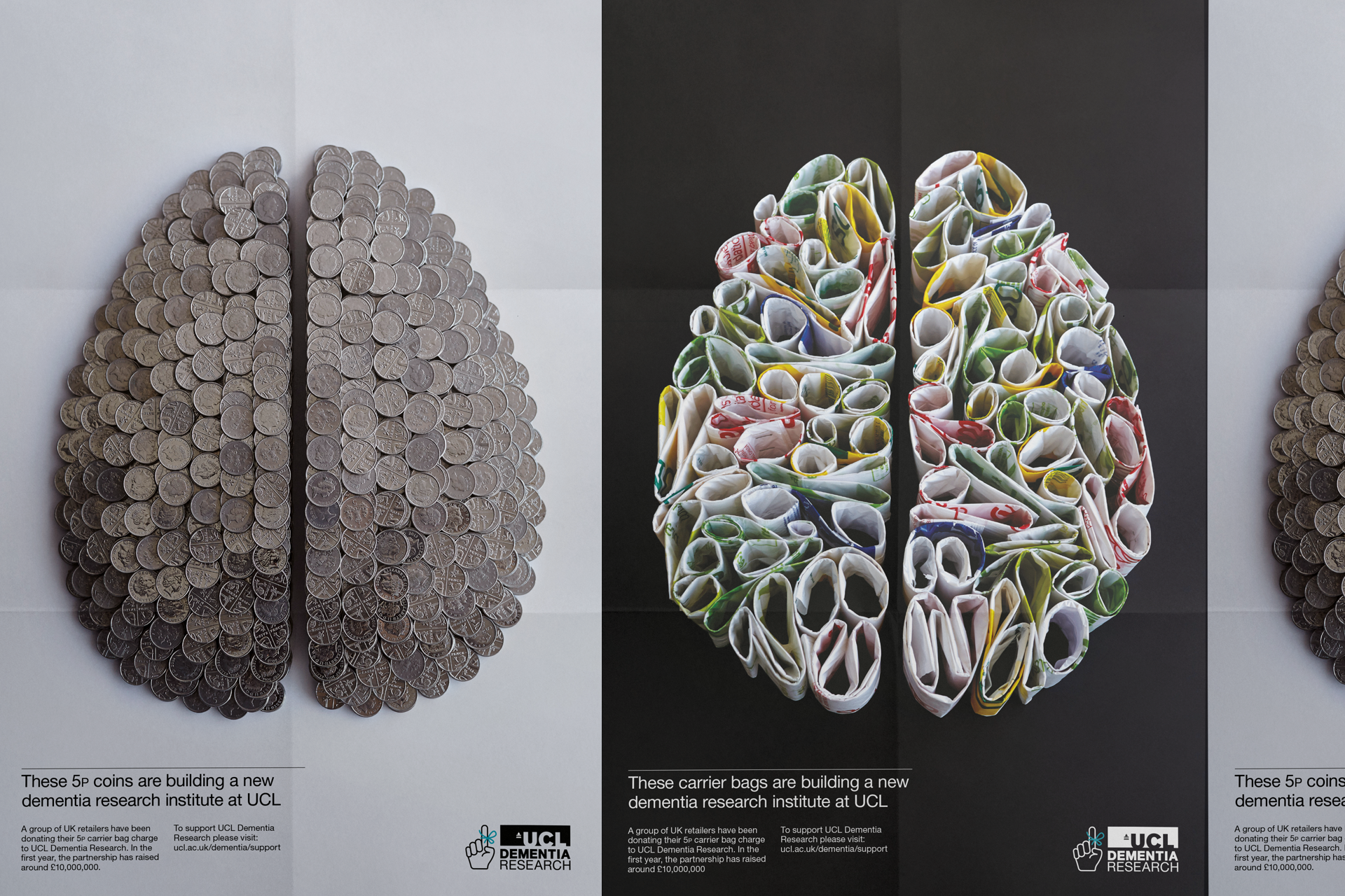 Building a new dementia research institute